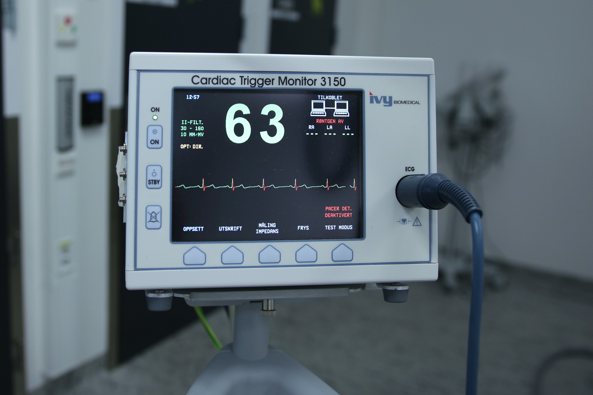 Electrocardiogram