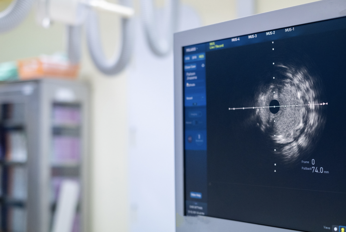 cardiac catheterization