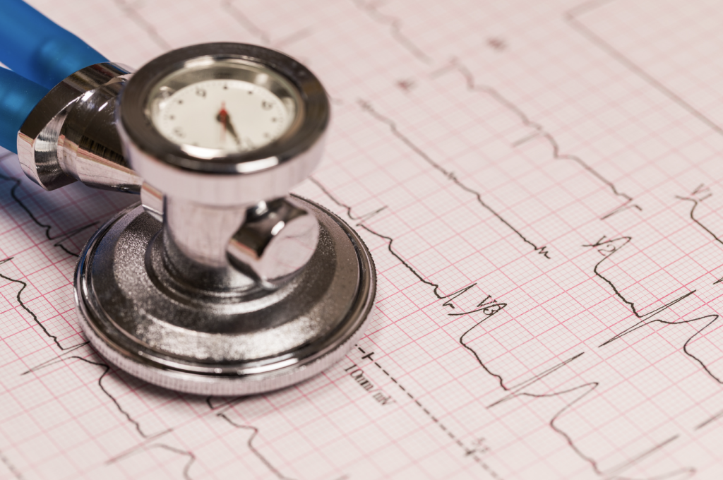 électrocardiogramme au repos