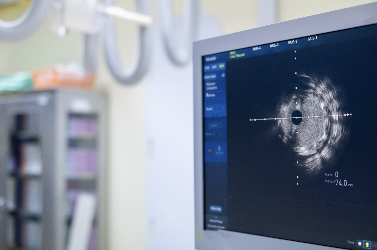 cardiac imaging